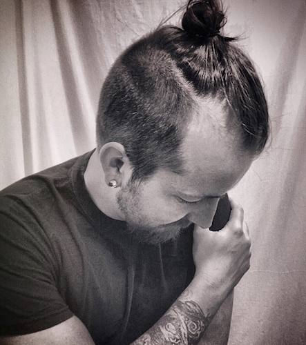 A photograph of a hipster male with a receding hairline and traction alopcia caused by a tighly-tied top knot hairstyle