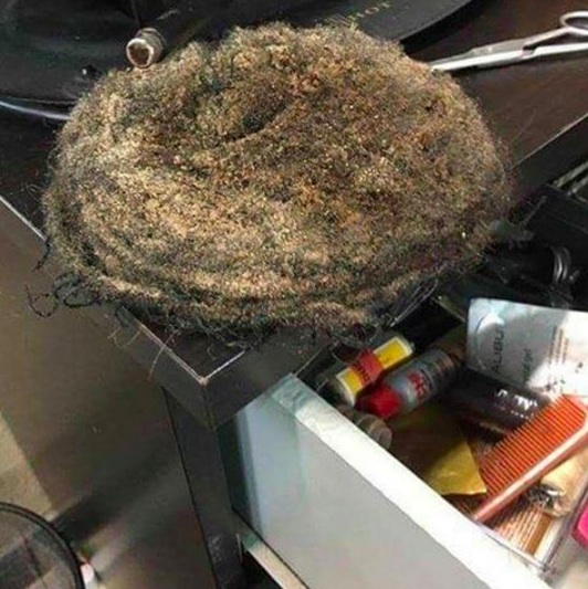 A hair-salon photograph of a putrefying hair weave that belonged to an African-American woman with long hair who was suffering from severe traction alopecia caused by the hair weave itself